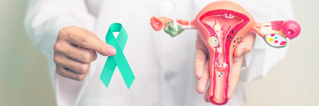 Médico sosteniendo lazo verde y modelo del aparato reproductor femenino, símbolo del cáncer de ovario
