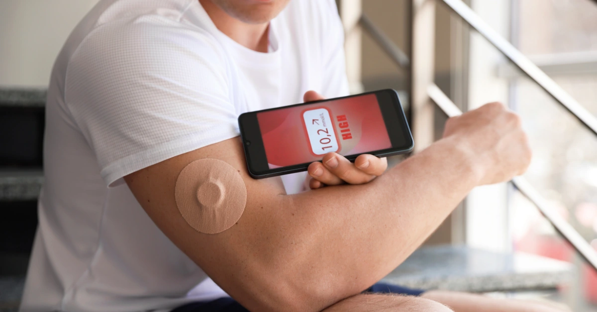 Hombre escaneando su nivel de azúcar con un monitor continuo de glucosa y un teléfono inteligente, aspecto clave en el control de la Diabetes y GLP-1.